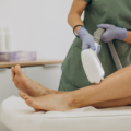 Cum să alegi un aparat de epilare definitive laser cu un buget redus dar calitativ?