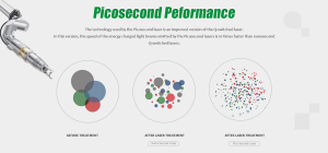 Aparat Laser Picosecond Real 350PS Profesional 1064nm & 532nm - diferenta intre nanosecunde si picosecunde